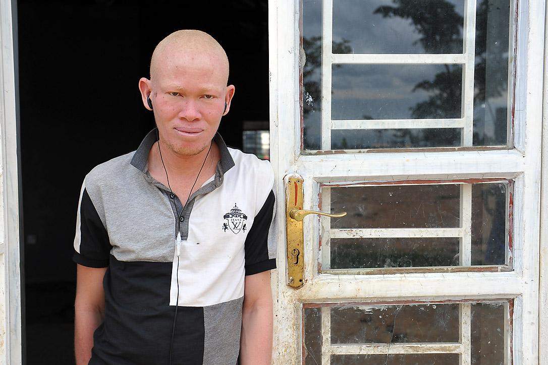 Patrick Tambure ist mit seiner Familie aus der Demokratischen Republik Kongo geflohen, weil sie dort nicht mehr sicher leben konnten. Er und vier seiner acht Geschwister leiden an Albinismus. Foto: LWB/M. Renaux (2015)